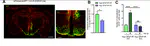 Astrocytic Insulin Signaling Couples Brain Glucose Uptake with Nutrient Availability