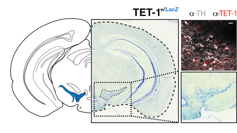 Midbrain Tet1 dosage defines inter-individual binge-eating susceptibility